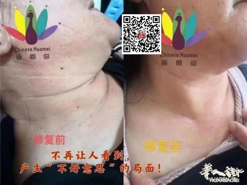 https://att.huarenjie.com/attachment/information/20260220/1771574743647838.jpg