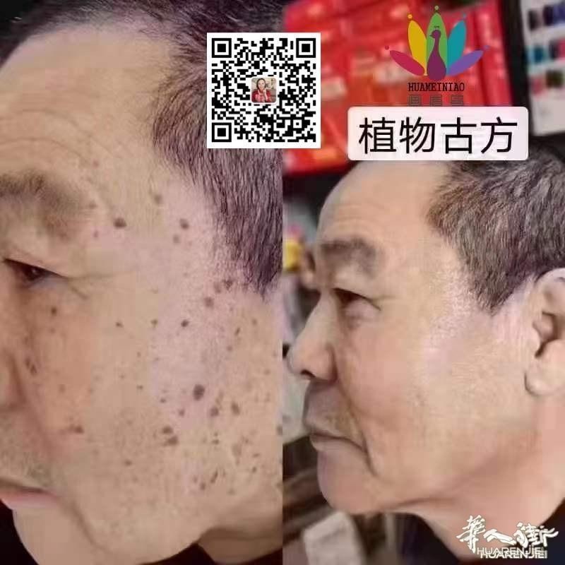 https://att.huarenjie.com/attachment/information/20260220/1771574738478696.jpg