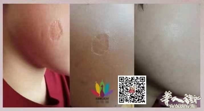 https://att.huarenjie.com/attachment/information/20260220/1771574817152088.jpg