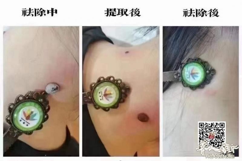 https://att.huarenjie.com/attachment/information/20260220/1771574783854523.jpg